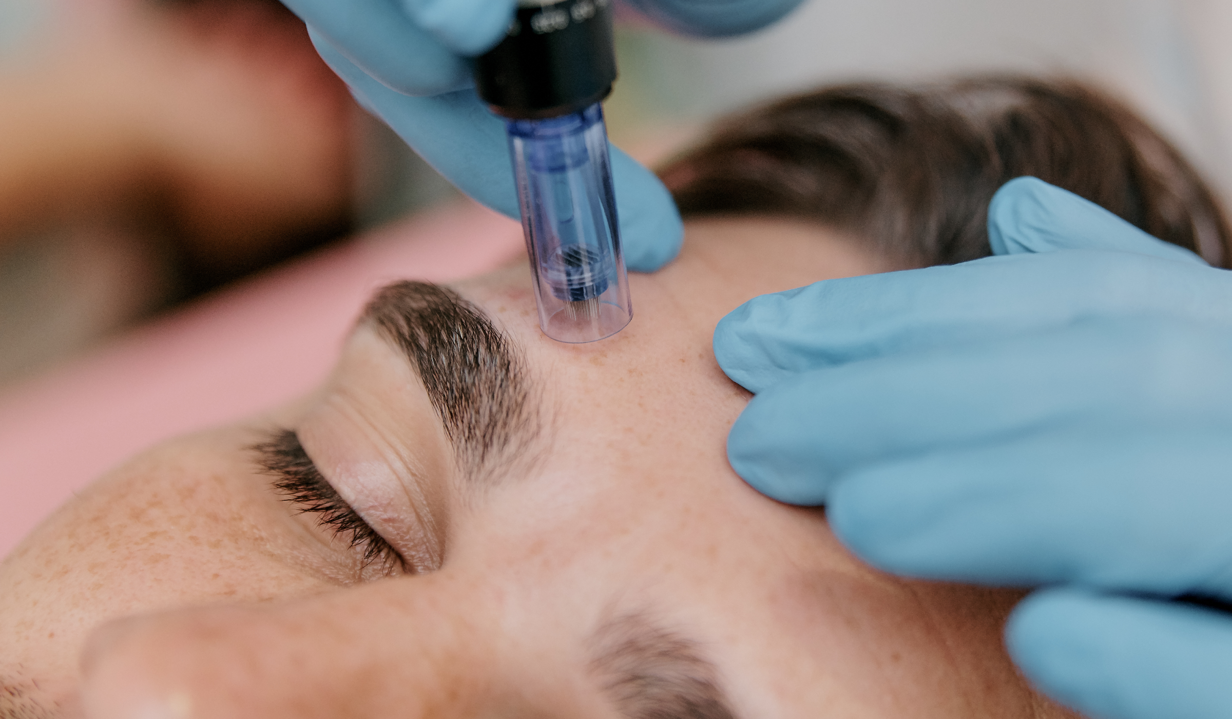 What Your Skin Really Needs After a Laser or Microneedling Treatment