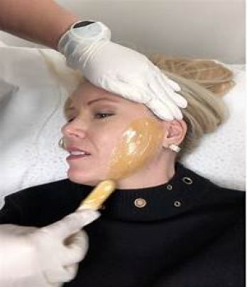 Upper Lip, Chin & Sides of Face Wax