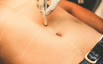 Plastic Surgery Trends to Watch in 2027
