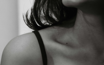 Which Hidradenitis Suppurativa Biologic Holds Up Best?