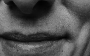 Thinking About Lip Filler Later in Life? Here’s What to Know