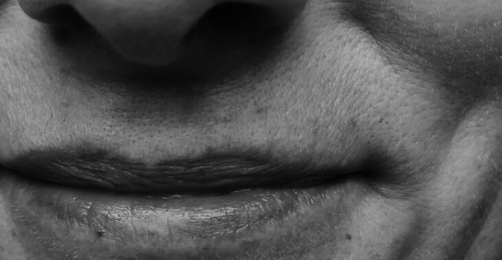 Thinking About Lip Filler Later in Life? Here’s What to Know