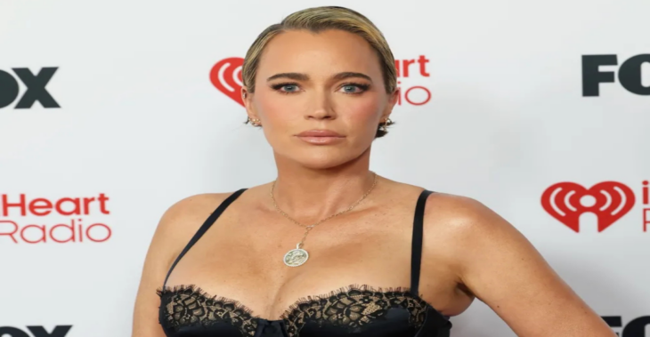Teddi Mellencamp Says She’s ‘Obsessed’ With Her Eyelid Surgery Results