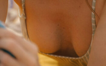 Plastic Surgeons Are Calling for a Ban on Breast Fillers