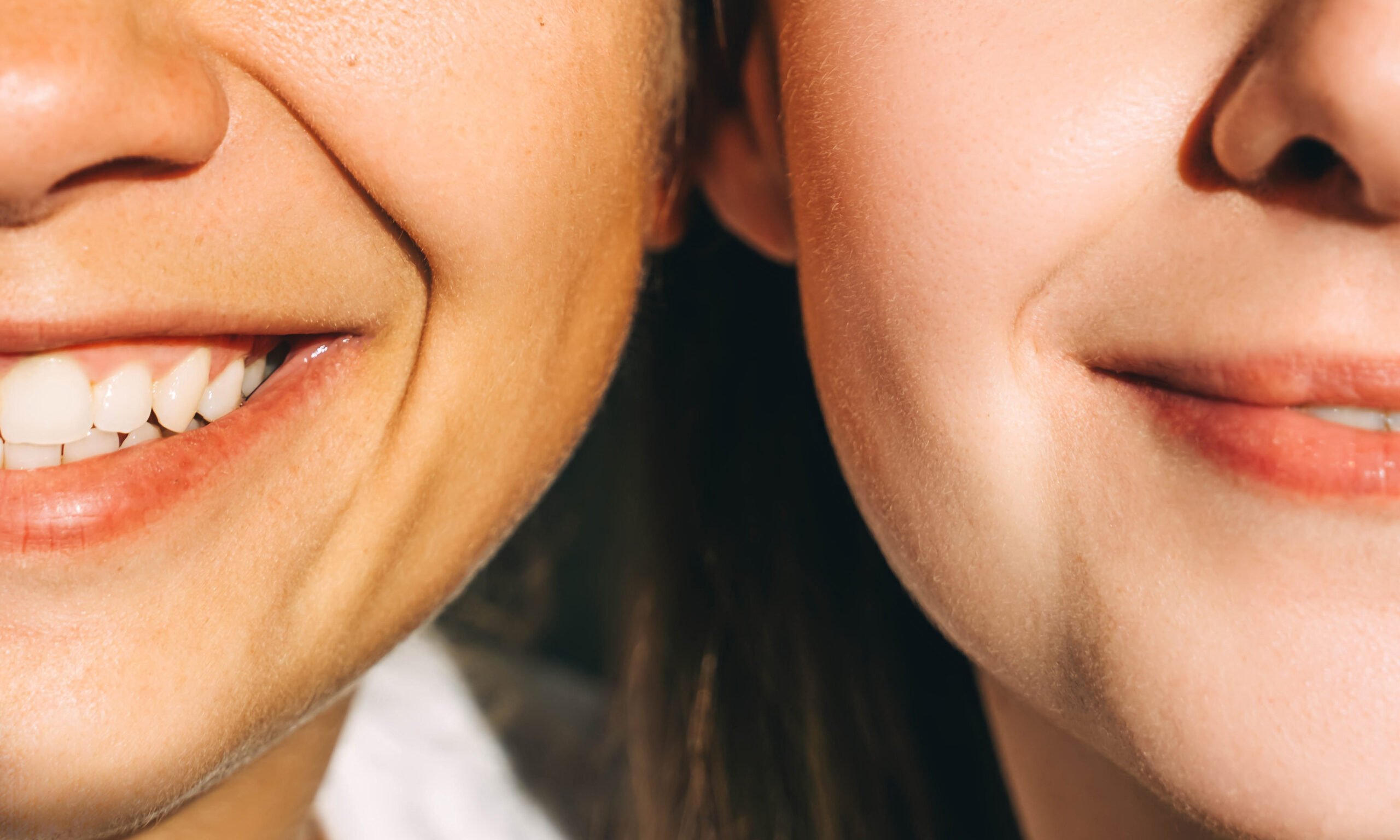 The Best In-Office Treatments for Smile Lines