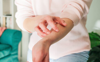 What Dermatologists Wish You Knew About Eczema