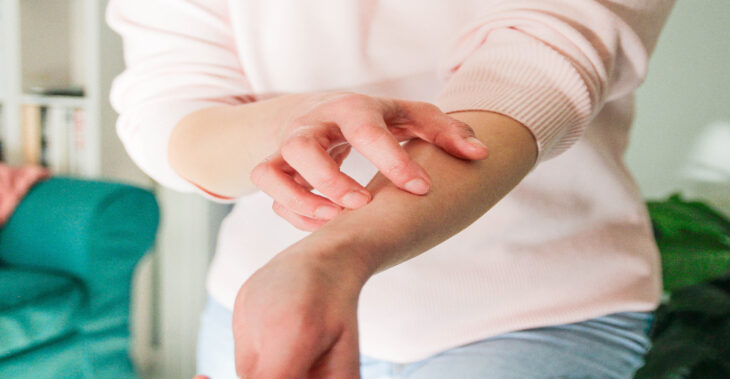 What Dermatologists Wish You Knew About Eczema