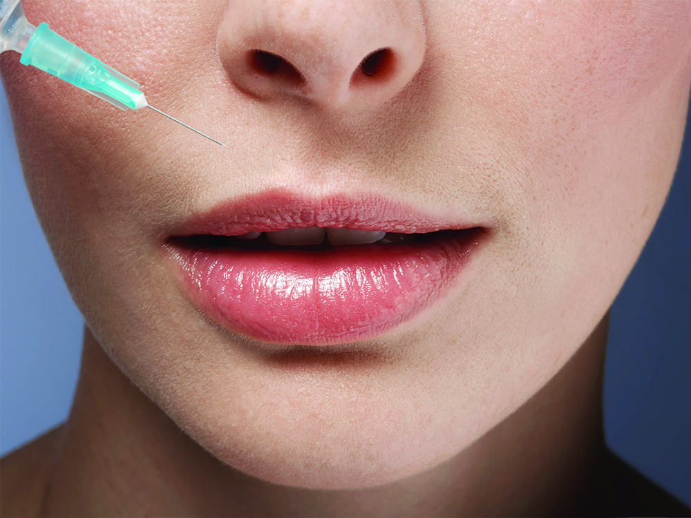 The ‘Natural’ Filler Trend Everyone’s Obsessed With—Explained