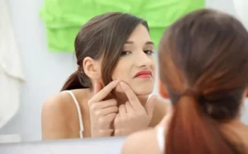 5 Foods That Worsen Acne – Avoid Them If You Have Problematic Skin